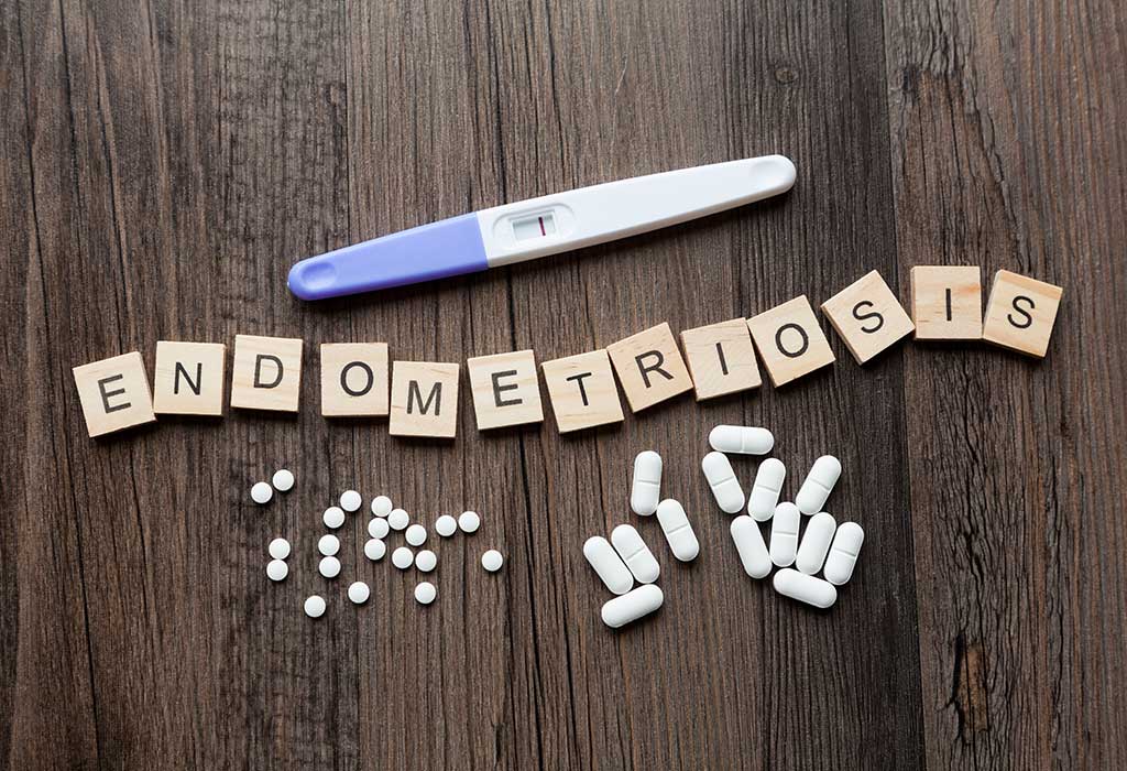 Endometrioza a IVF